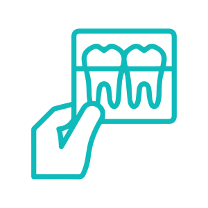 quy-trinh-nieng-rang-1