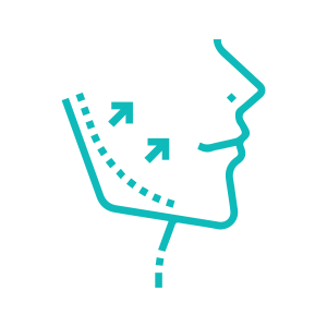 quy trình chồng răng Implant: bước 4